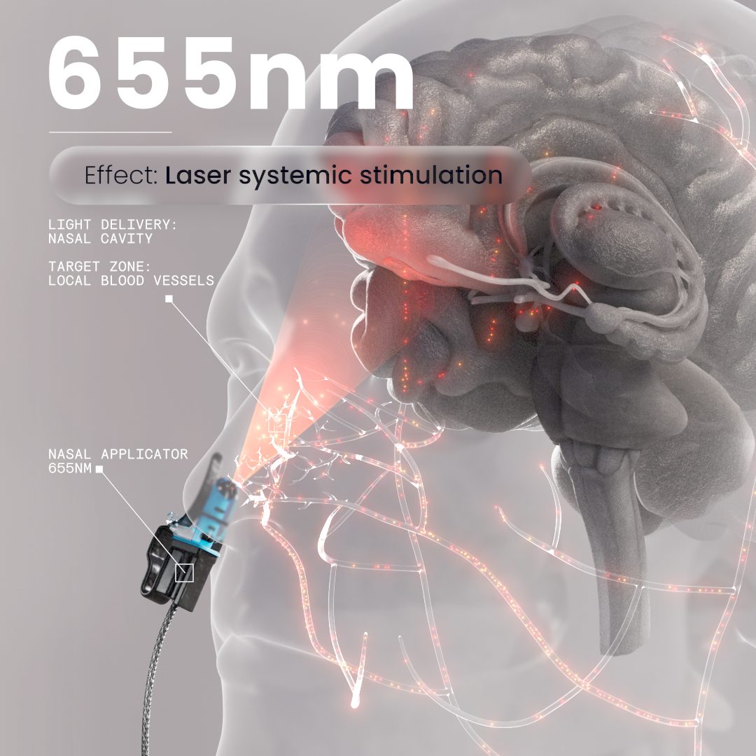 Vielight MIP 655 nm applicator, light path guide #Configuration_MIP 655-810